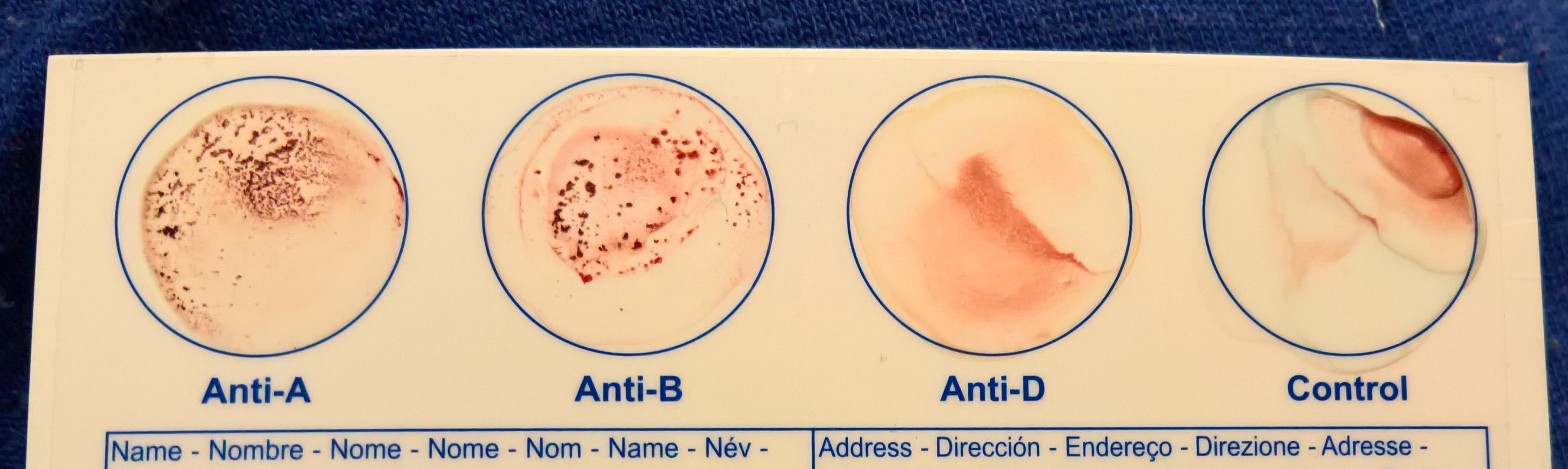 Photo of Eldoncard ABO Rhesus D blood test